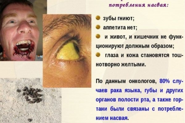 Как восстановить страницу на кракене